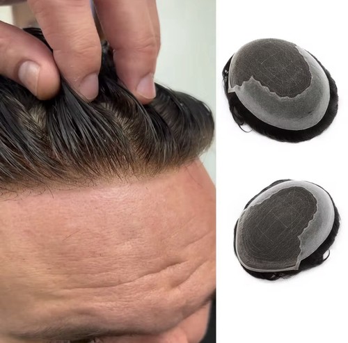 Full lace hair replacement - full,